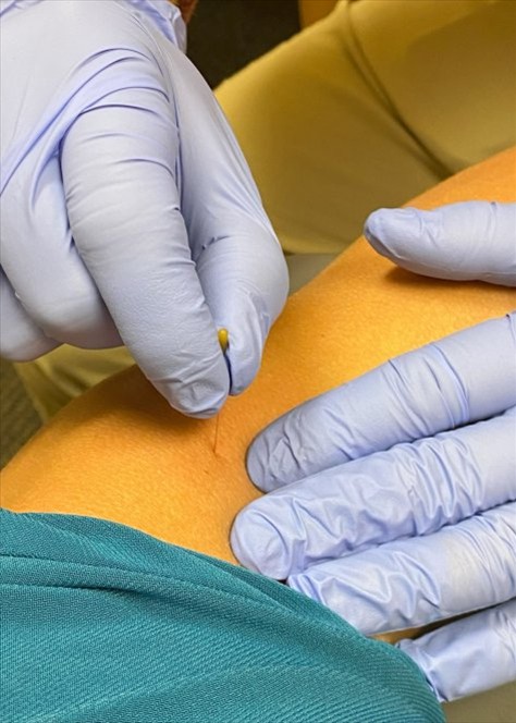 A physical therapist performs a specialty service